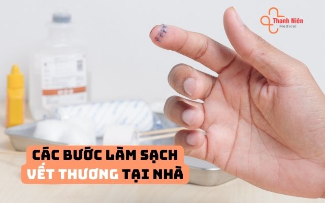 Các bước làm sạch vết thương tại nhà