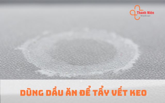 Dùng dầu ăn để tẩy vết keo