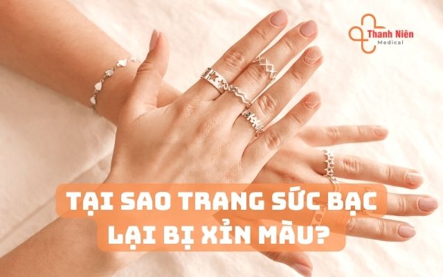 Tại sao trang sức bạc lại bị xỉn màu? 