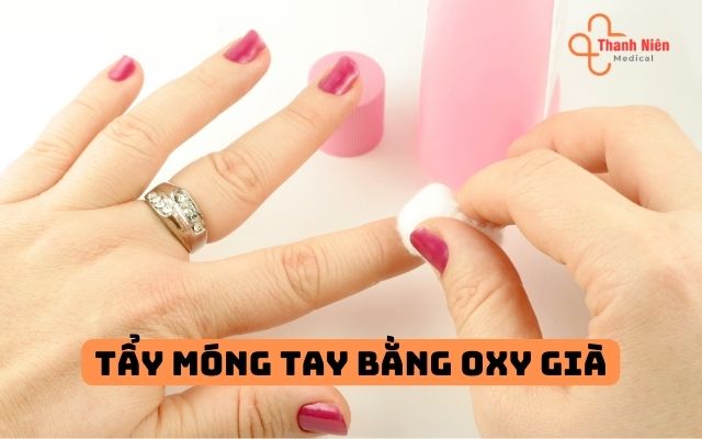 Tẩy móng bằng oxy già