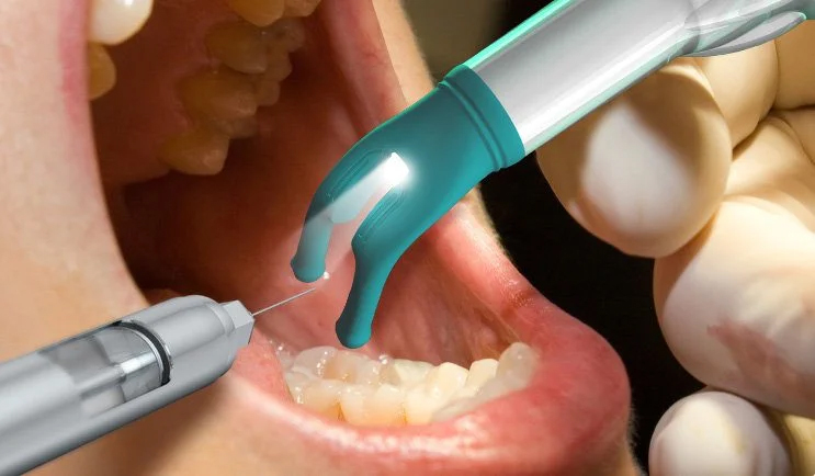 Gây tê tại chỗ giúp bệnh nhân không cảm thấy đau trong quá trình điều trị